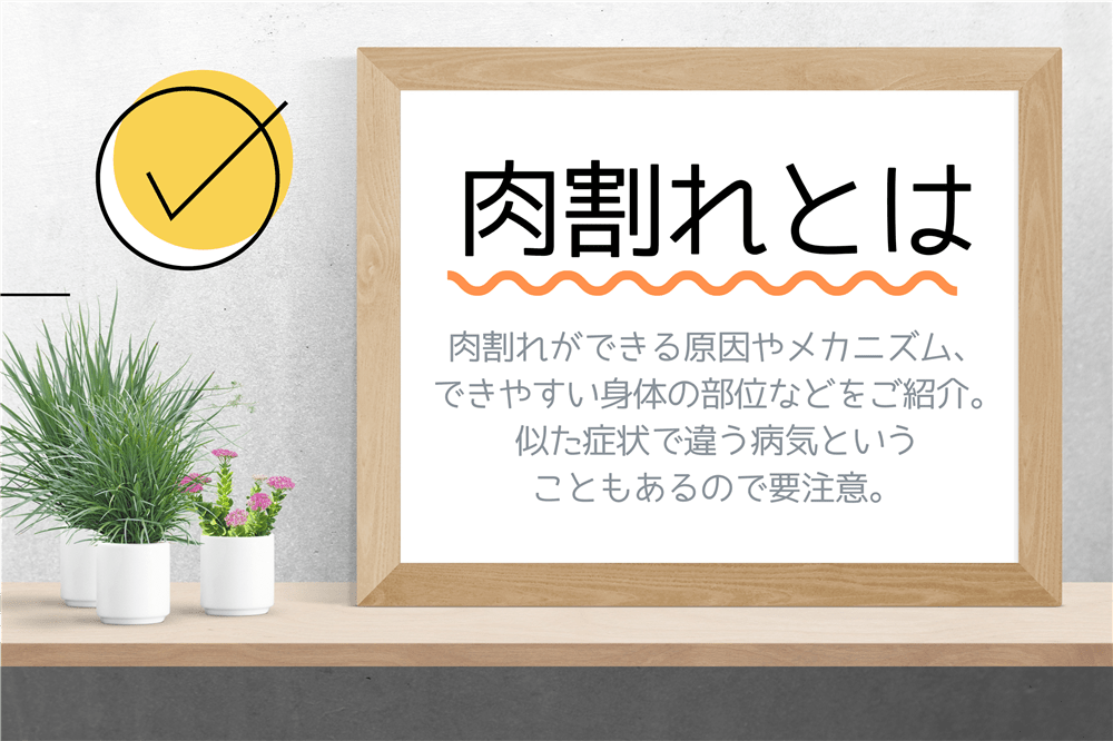 肉割れの原因や症状、ケアの考え方をまとめた基礎知識ガイド